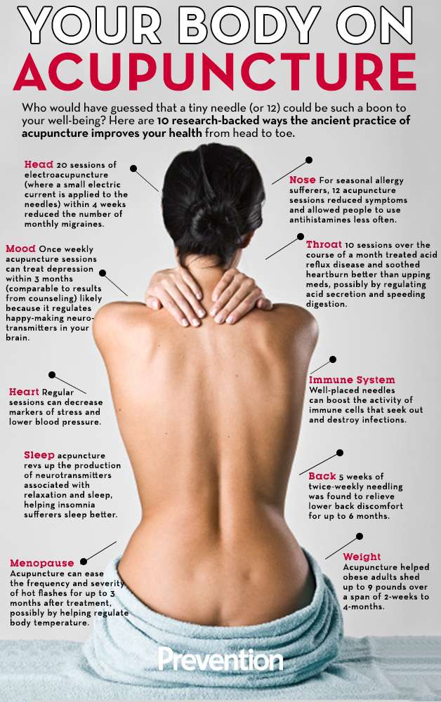 Is Acupuncture Good for You